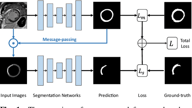 Figure 1 for Joint Deep Learning for Improved Myocardial Scar Detection from Cardiac MRI