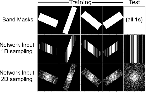 Figure 4 for K-band: Self-supervised MRI Reconstruction via Stochastic Gradient Descent over K-space Subsets