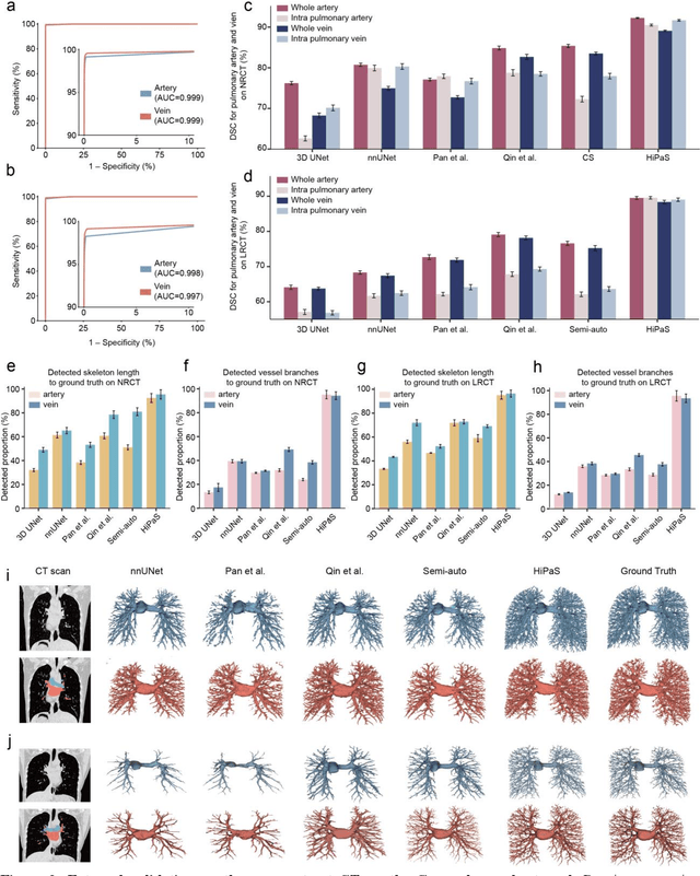 Figure 3 for Deep learning-driven pulmonary arteries and veins segmentation reveals demography-associated pulmonary vasculature anatomy