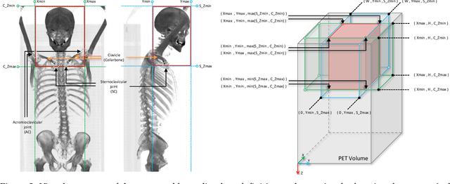 Figure 3 for Segmentation-Free Outcome Prediction in Head and Neck Cancer: Deep Learning-based Feature Extraction from Multi-Angle Maximum Intensity Projections (MA-MIPs) of PET Images