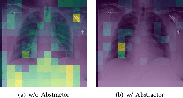 Figure 3 for Topicwise Separable Sentence Retrieval for Medical Report Generation