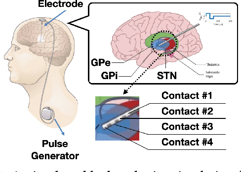 Figure 1 for Offline Learning of Closed-Loop Deep Brain Stimulation Controllers for Parkinson Disease Treatment