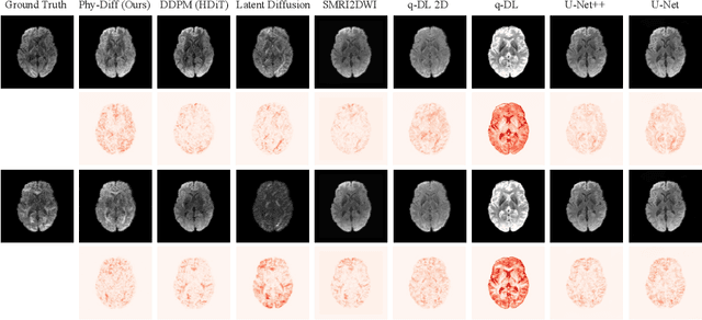 Figure 4 for Phy-Diff: Physics-guided Hourglass Diffusion Model for Diffusion MRI Synthesis