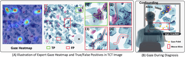 Figure 1 for Gaze-DETR: Using Expert Gaze to Reduce False Positives in Vulvovaginal Candidiasis Screening