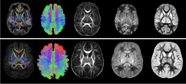 Figure 1 for Characterizing normal perinatal development of the human brain structural connectivity