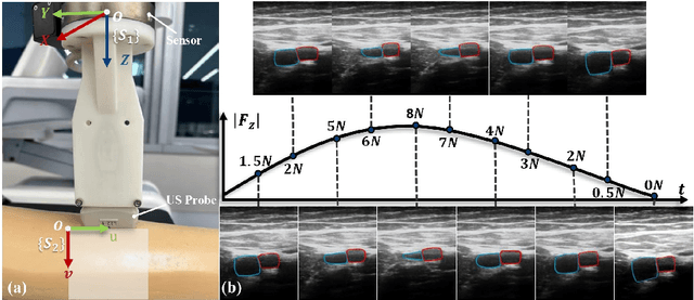 Figure 1 for Force Sensing Guided Artery-Vein Segmentation via Sequential Ultrasound Images