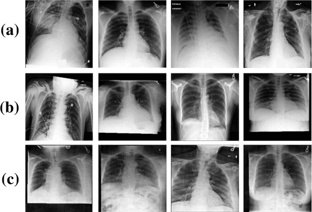 Figure 4 for Backdoor Attack on Unpaired Medical Image-Text Foundation Models: A Pilot Study on MedCLIP