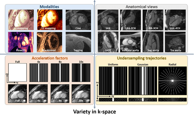 Figure 1 for CMRxRecon2024: A Multi-Modality, Multi-View K-Space Dataset Boosting Universal Machine Learning for Accelerated Cardiac MRI