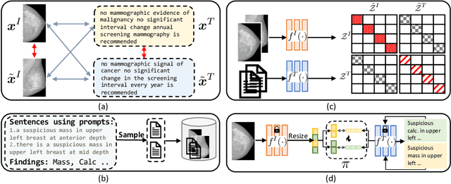Figure 1 for Mammo-CLIP: A Vision Language Foundation Model to Enhance Data Efficiency and Robustness in Mammography