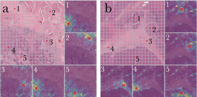 Figure 4 for Masked Pre-Training of Transformers for Histology Image Analysis