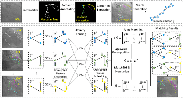 Figure 1 for Multi-graph Graph Matching for Coronary Artery Semantic Labeling