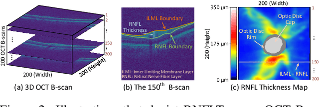 Figure 3 for Harvard Glaucoma Fairness: A Retinal Nerve Disease Dataset for Fairness Learning and Fair Identity Normalization