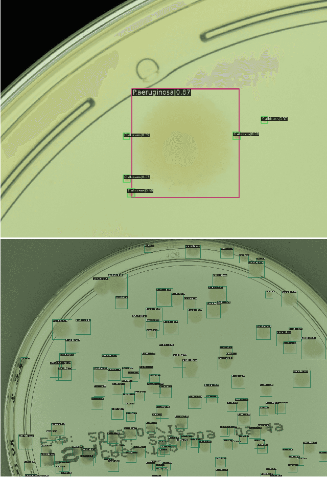 Figure 1 for Transformer-based Detection of Microorganisms on High-Resolution Petri Dish Images