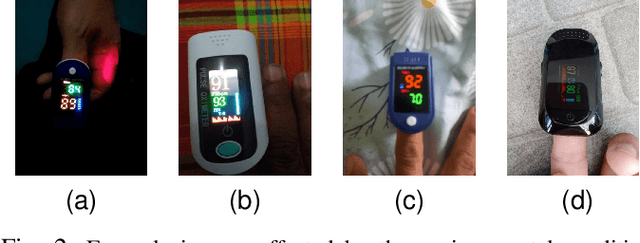 Figure 2 for PACMAN: a framework for pulse oximeter digit detection and reading in a low-resource setting