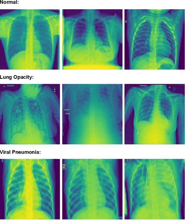 Figure 1 for Deep Learning for Lung Disease Classification Using Transfer Learning and a Customized CNN Architecture with Attention