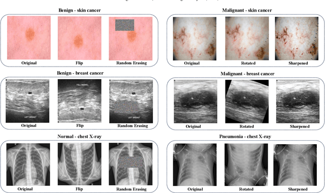 Figure 1 for BayTTA: Uncertainty-aware medical image classification with optimized test-time augmentation using Bayesian model averaging