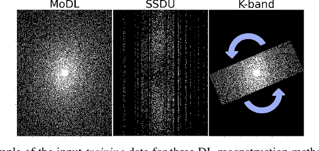 Figure 1 for Deep Learning for Accelerated and Robust MRI Reconstruction: a Review