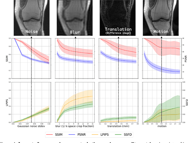 Figure 4 for Deep Learning for Accelerated and Robust MRI Reconstruction: a Review