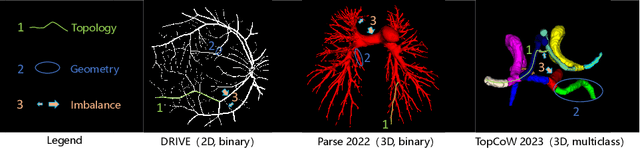 Figure 1 for Centerline Boundary Dice Loss for Vascular Segmentation