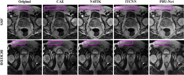 Figure 3 for A Probabilistic Hadamard U-Net for MRI Bias Field Correction