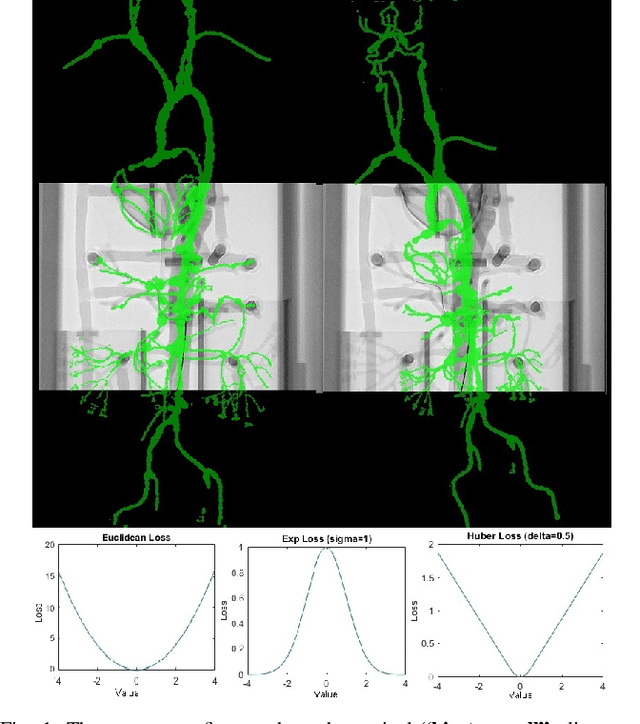 Figure 1 for Iterative PnP and its application in 3D-2D vascular image registration for robot navigation