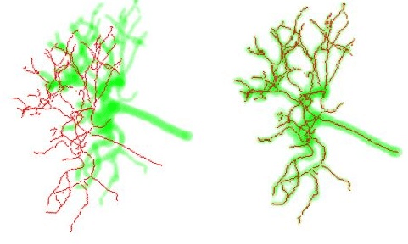 Figure 2 for Iterative PnP and its application in 3D-2D vascular image registration for robot navigation