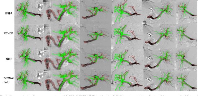 Figure 3 for Iterative PnP and its application in 3D-2D vascular image registration for robot navigation