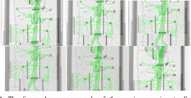 Figure 4 for Iterative PnP and its application in 3D-2D vascular image registration for robot navigation