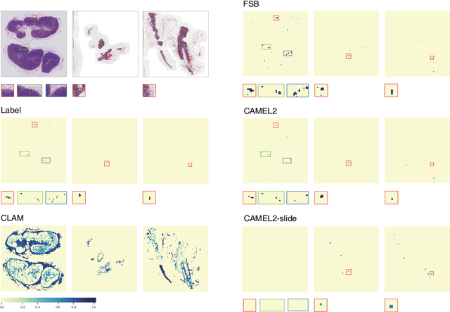 Figure 4 for CAMEL2: Enhancing weakly supervised learning for histopathology images by incorporating the significance ratio