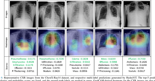 Figure 4 for HydraViT: Adaptive Multi-Branch Transformer for Multi-Label Disease Classification from Chest X-ray Images