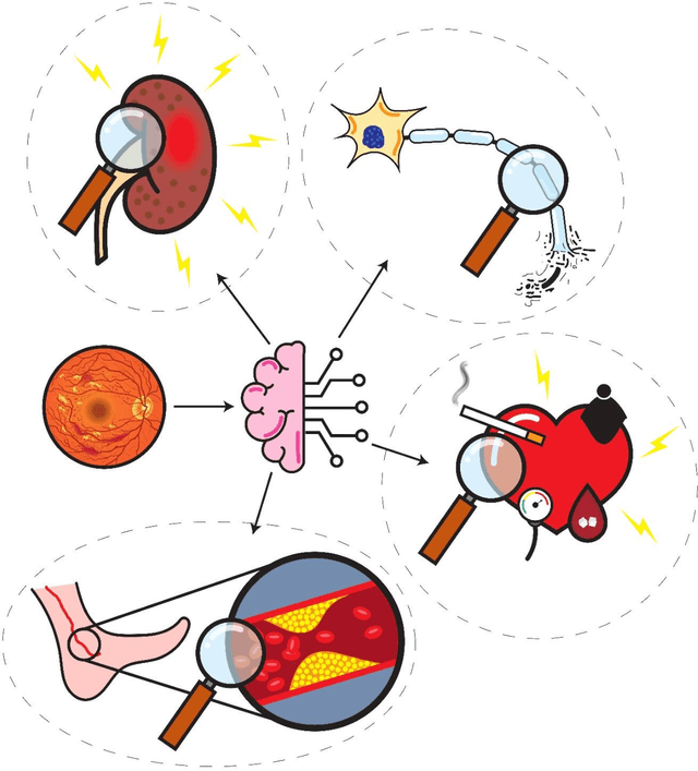 Figure 1 for Artificial Intelligence and Diabetes Mellitus: An Inside Look Through the Retina