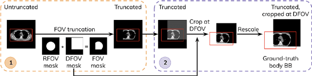 Figure 3 for Diffusion-based Generative Image Outpainting for Recovery of FOV-Truncated CT Images