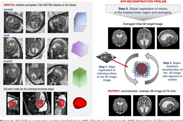 Figure 1 for A Literature Review on Fetus Brain Motion Correction in MRI