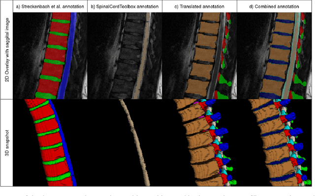 Figure 2 for SPINEPS -- Automatic Whole Spine Segmentation of T2-weighted MR images using a Two-Phase Approach to Multi-class Semantic and Instance Segmentation