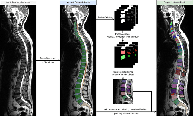 Figure 3 for SPINEPS -- Automatic Whole Spine Segmentation of T2-weighted MR images using a Two-Phase Approach to Multi-class Semantic and Instance Segmentation