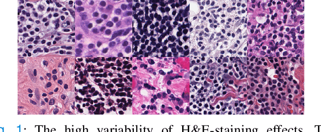 Figure 1 for A Laplacian Pyramid Based Generative H&E Stain Augmentation Network