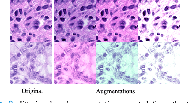 Figure 4 for A Laplacian Pyramid Based Generative H&E Stain Augmentation Network
