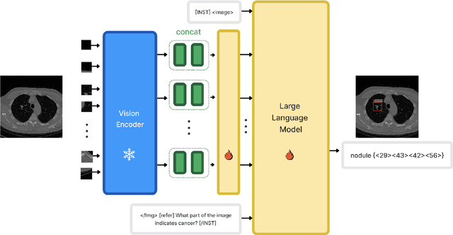 Figure 3 for MiniGPT-Med: Large Language Model as a General Interface for Radiology Diagnosis