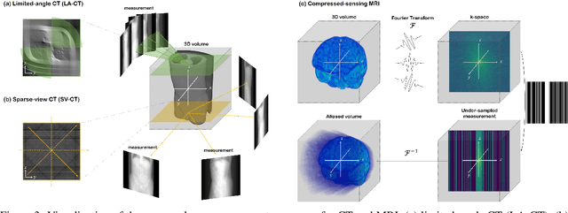 Figure 3 for Physics-Inspired Generative Models in Medical Imaging: A Review