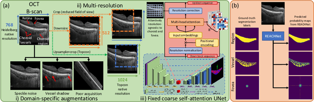 Figure 1 for Domain-specific augmentations with resolution agnostic self-attention mechanism improves choroid segmentation in optical coherence tomography images