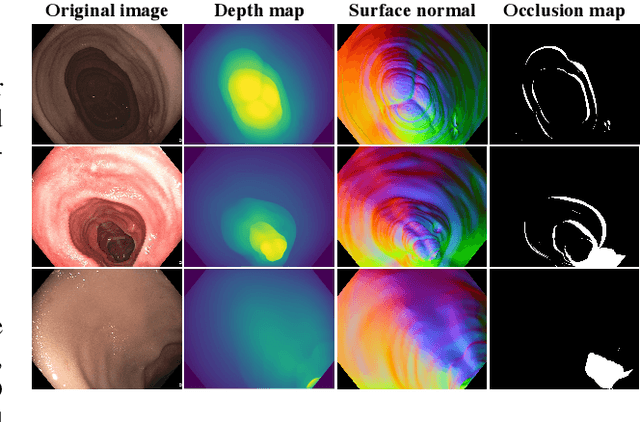 Figure 1 for Multi-task learning with cross-task consistency for improved depth estimation in colonoscopy