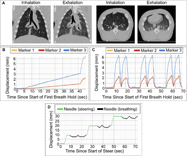 Figure 3 for Autonomous Medical Needle Steering In Vivo