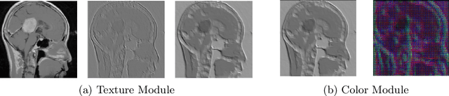 Figure 3 for Adversarial-Robust Transfer Learning for Medical Imaging via Domain Assimilation