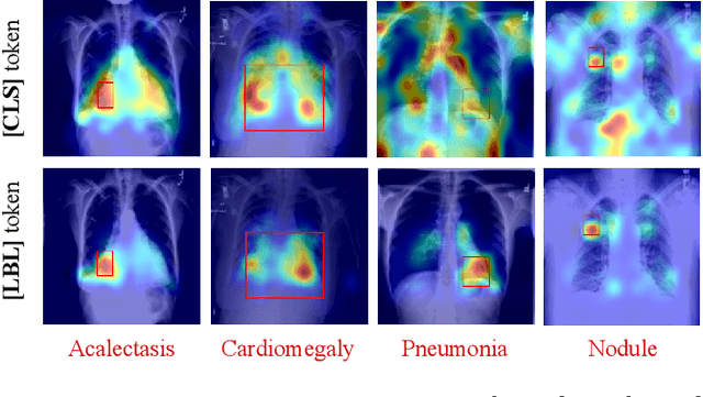 Figure 4 for LT-ViT: A Vision Transformer for multi-label Chest X-ray classification