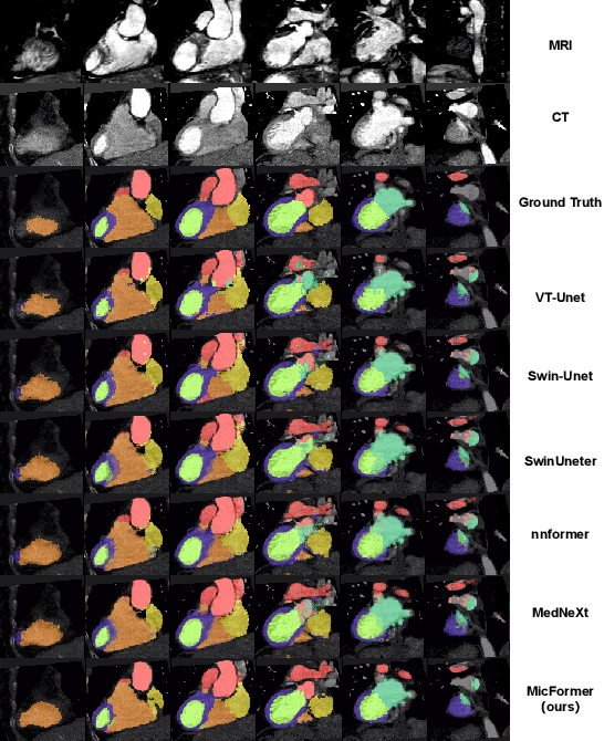 Figure 4 for Multimodal Information Interaction for Medical Image Segmentation