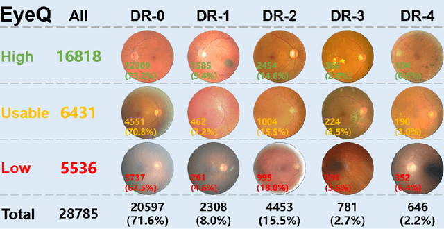 Figure 1 for Is Dataset Quality Still a Concern in Diagnosis Using Large Foundation Model?