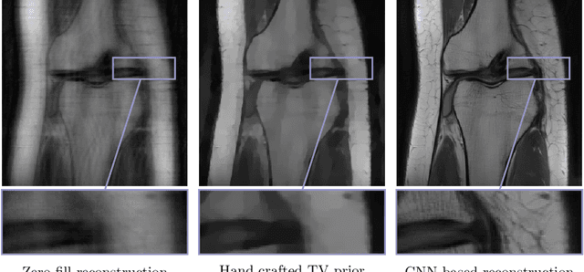 Figure 1 for Neural-network-based regularization methods for inverse problems in imaging