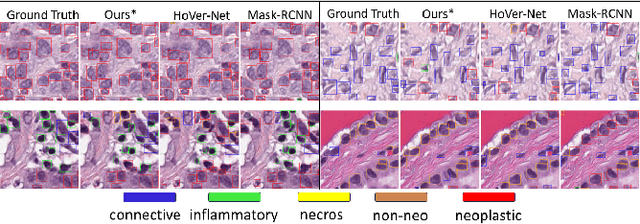 Figure 3 for Pathological Primitive Segmentation Based on Visual Foundation Model with Zero-Shot Mask Generation