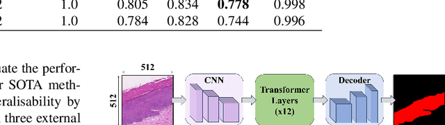 Figure 2 for Transformer-based Model for Oral Epithelial Dysplasia Segmentation