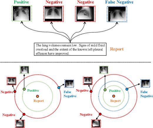 Figure 1 for MLIP: Enhancing Medical Visual Representation with Divergence Encoder and Knowledge-guided Contrastive Learning